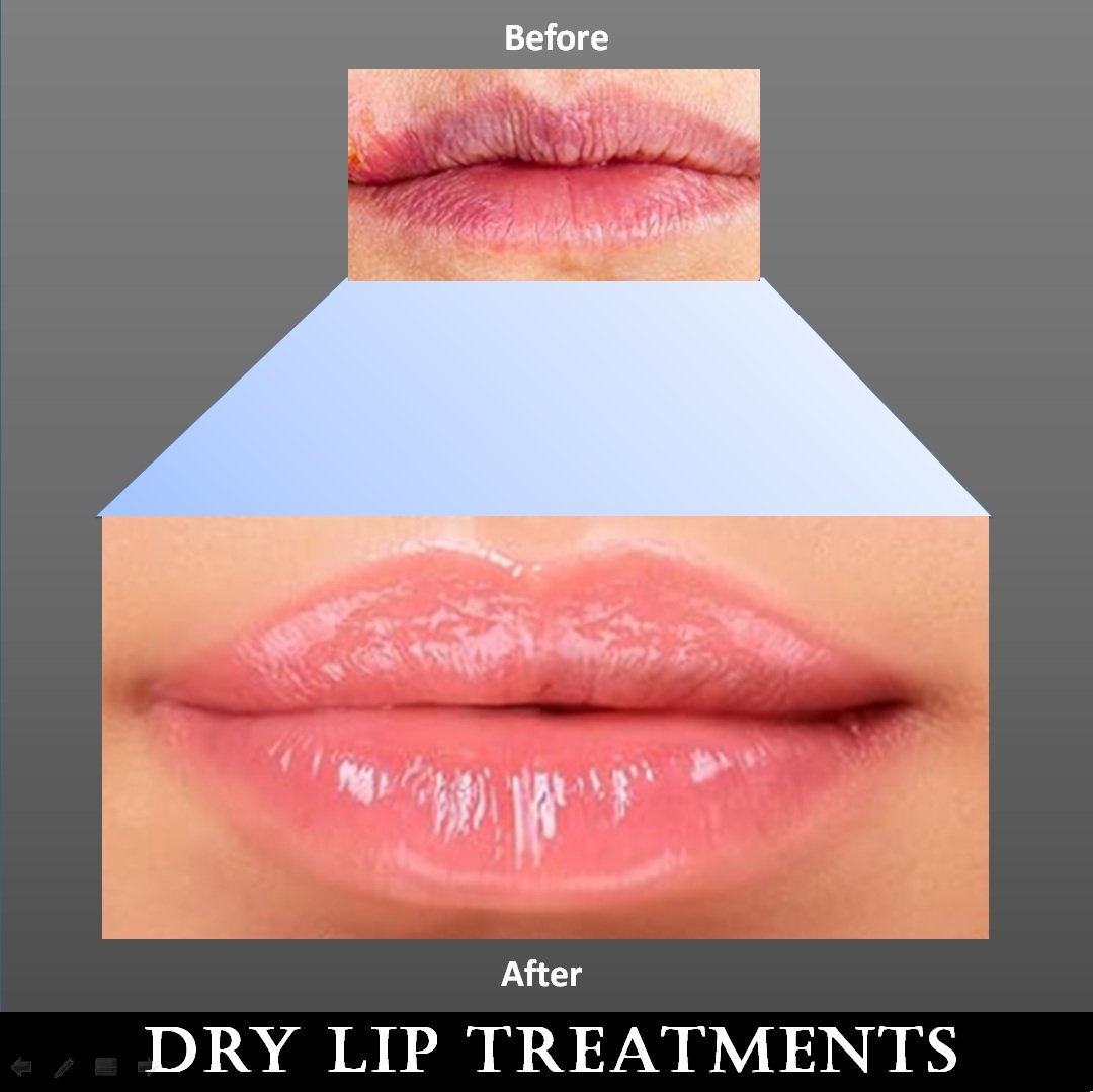 lip moisturizer kids girl