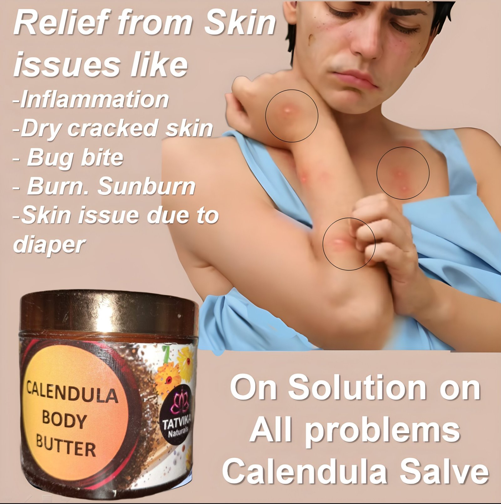 ExtraLarge Calendula cream by Tatvika Naturals, calendula anti acne Salve, stretch mark removal body butter, foot cream for dry and cracked feet, ointment 100g - Image 2