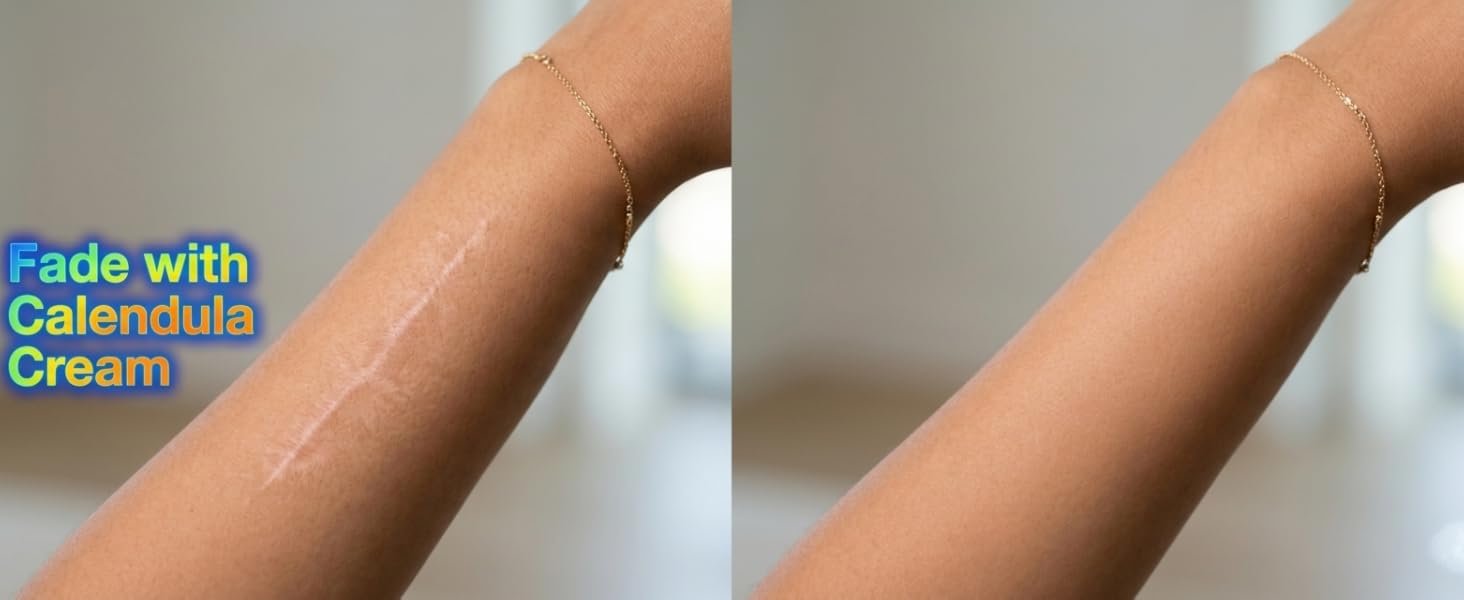 Tatvika Naturals Scar cream