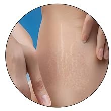 Tatvika Naturals stretch mark cream