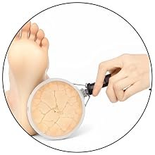 Tatvika Naturals foot cream for dry and cracked feet